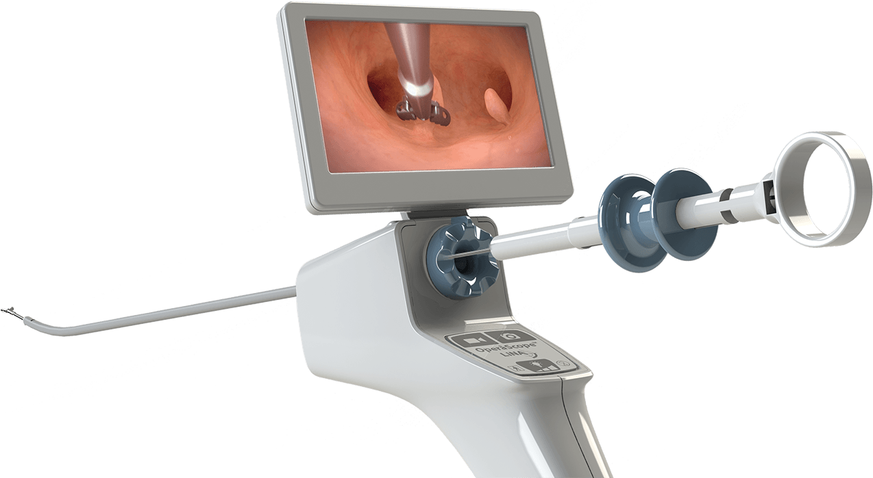 LiNA OperåScope™ Single-Use Operative Hysteroscopy System – LiNA Medical